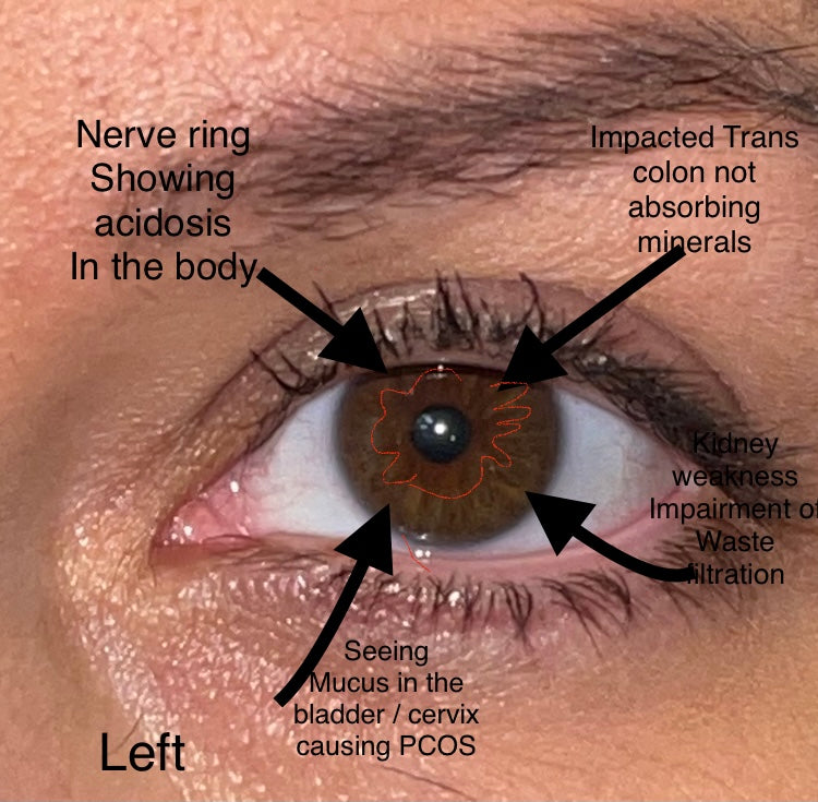 Iridology Exam